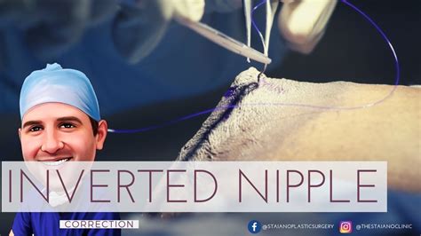 pointy nips|Inverted & Flat Nipples: Causes & Treatment .